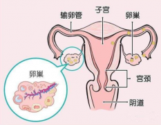 试管婴儿前卵巢功能检查包括哪些