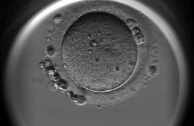 做试管婴儿促排卵后，为什么会取到空卵泡呢？